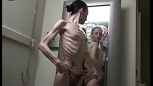 anorexic jessica 02