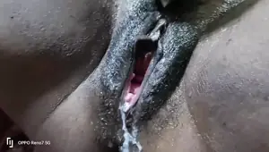 Today I Expelled Water From the Vagina Many Times Along with Foam From the Vagina
